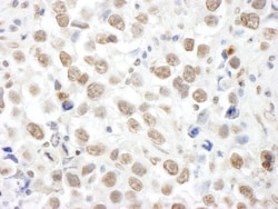 TOPORS Antibody, Novus Biologicals 0.1mL; Unlabeled:Antibodies, Polyclonal